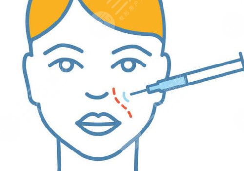 幼態(tài)減齡臉需要整什么？