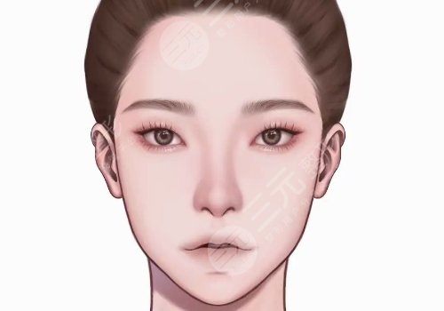 輪廓手術(shù)過程圖片|網(wǎng)友恢復(fù)案例