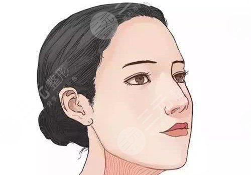 輪廓手術(shù)過程圖片|網(wǎng)友恢復(fù)案例