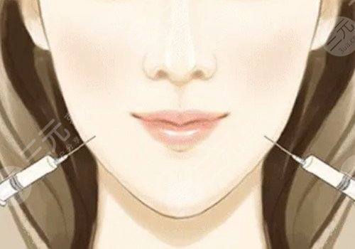 微調(diào)整形都有什么項(xiàng)目？