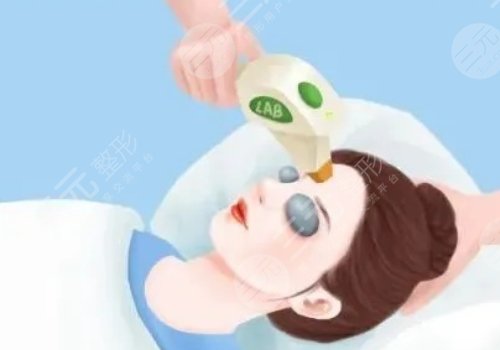 微調(diào)整形都有什么項(xiàng)目？