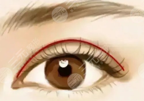 北京清木醫(yī)療美容醫(yī)院正規(guī)嗎？