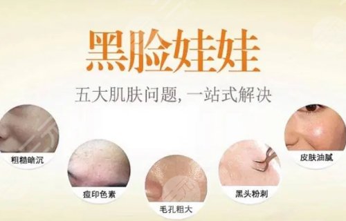 黑臉娃娃有什么功效？