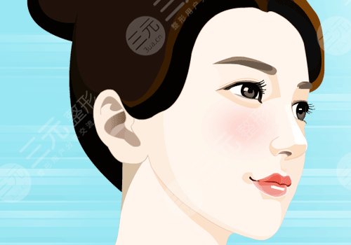 美國(guó)菲斯挺膨體適合放在鼻子哪里？