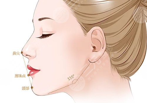 美國(guó)菲斯挺膨體適合放在鼻子哪里？