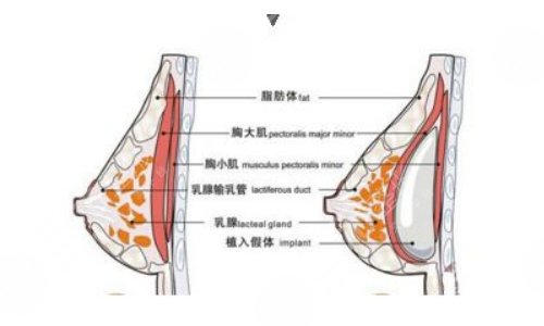 強(qiáng)生傲諾拉和曼托區(qū)別在哪？