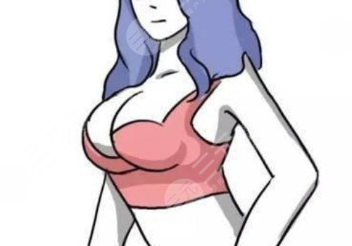 殷初陽(yáng)隆胸手術(shù)好嗎?