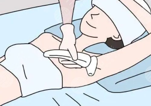 脫毛用哪種方法好？