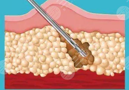 如何有效減肥不反彈？