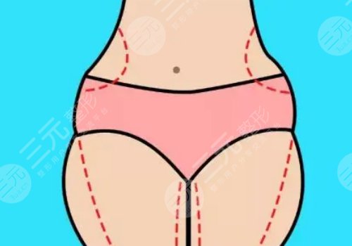 如何有效減肥不反彈？