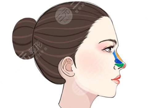 硅膠隆鼻好不好？