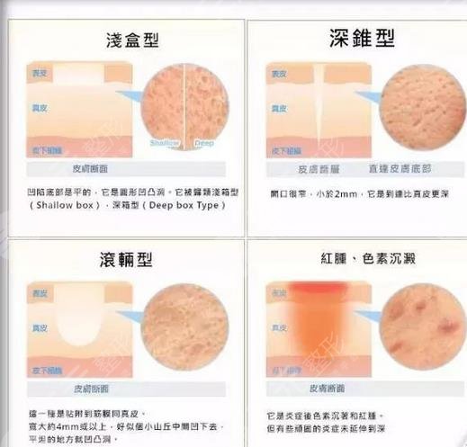 廣州曙光整形醫(yī)院做激光好嗎?