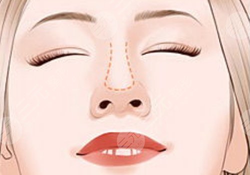 鄭州大學第二附屬醫(yī)院整形科怎么樣