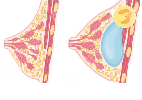 鄭州大學第二附屬醫(yī)院整形科怎么樣