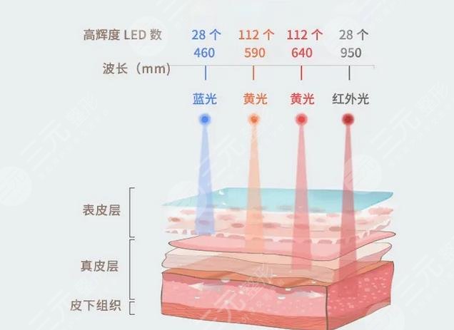 激光緩解臉部紅血絲怎么樣?