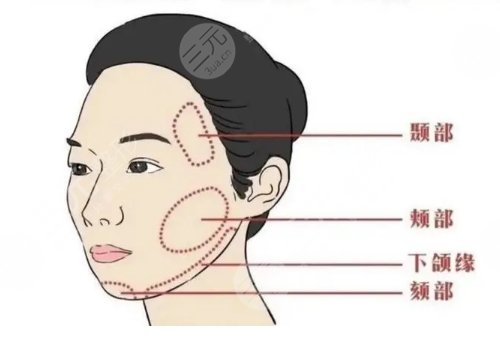 面部輪廓固定適合多大年齡