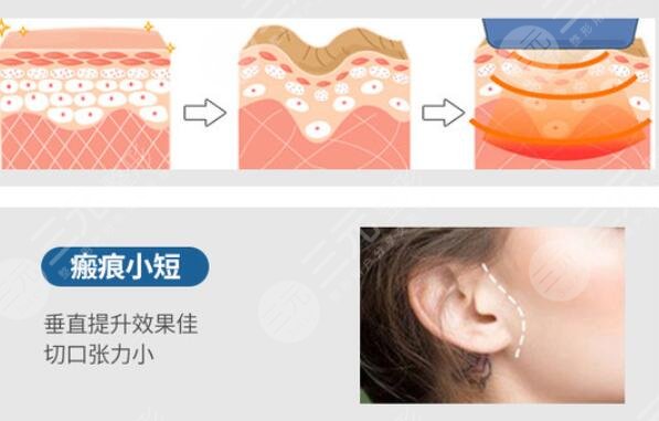 重慶美侖美奐杜亞旭醫(yī)生擅長(zhǎng)項(xiàng)目科普