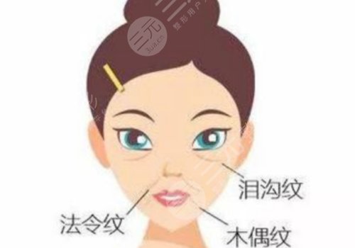 全臉輪廓固定能維持多久