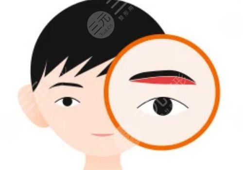 提眉的好處和壞處有什么？