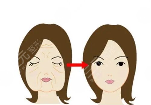 面部輪廓固定需要多少錢？