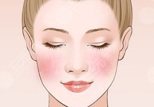 豐顏玻尿酸多久能消腫？