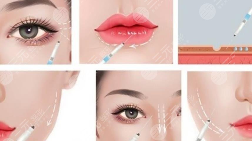 少女針和童顏針哪個安全