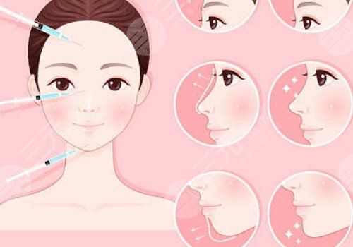 注射艾維嵐多久消腫