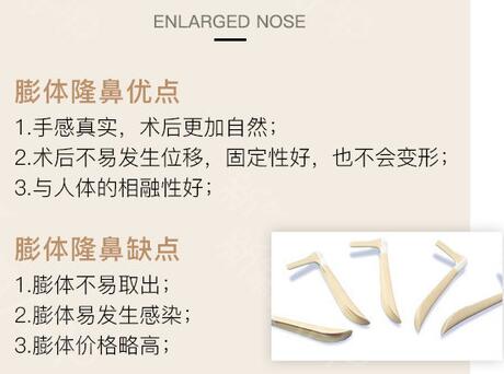 膨體隆鼻恢復(fù)時間多久？科普小課堂！深度了解優(yōu)缺點、價格~