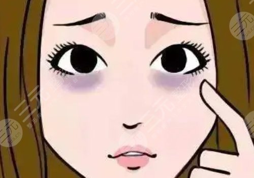 去黑眼圈的醫(yī)美項(xiàng)目多少錢(qián)？有哪些？