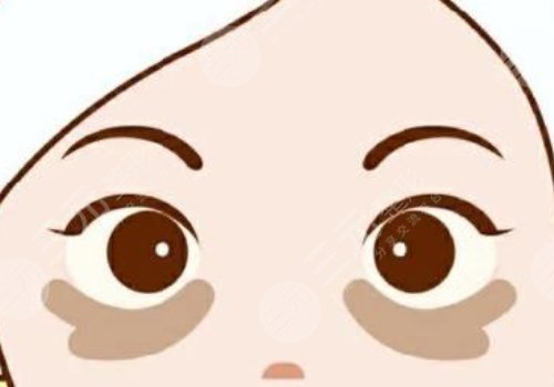 去黑眼圈的醫(yī)美項(xiàng)目多少錢(qián)？有哪些？