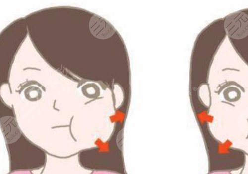 咬肌太大怎么辦如何讓咬肌變??？