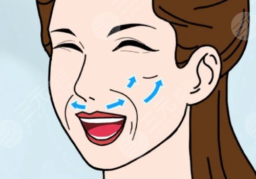 法令紋太深了有什么解決辦法？