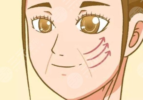 法令紋太深了有什么解決辦法？