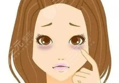 去黑眼圈和眼袋有效的方法是什么？眼周抗衰指南！