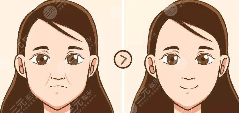 自體脂肪填充面部