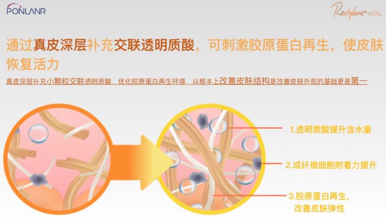 貴婦水光效果怎么樣？高奢維養(yǎng)，美膚指南！