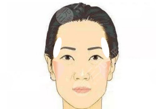 中庭太長(zhǎng)怎么改良？