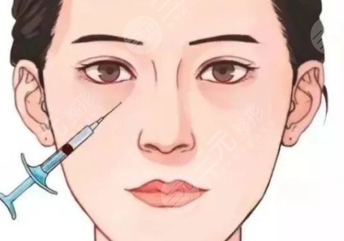 雙美膠原蛋白填充淚溝能維持多久？