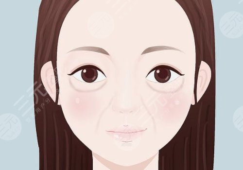 雙美膠原蛋白填充淚溝能維持多久？