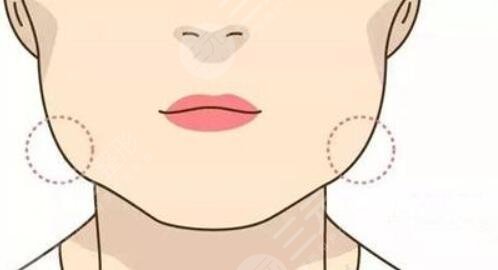 姜民范景熙翔磨骨誰好？2位醫(yī)生實力、臨床經(jīng)驗、術(shù)后反饋多方比較~