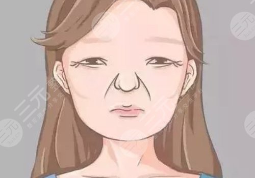 括號紋怎么去掉？怎么形成的？改良方式解讀！