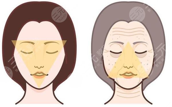 拉皮手術(shù)的實(shí)際效果如何?