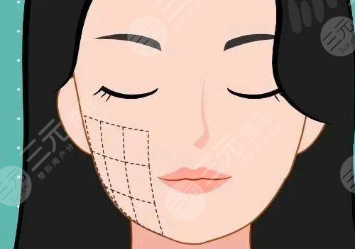 輪廓針一般打幾針