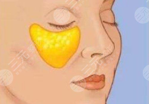 眼窩凹陷用什么填充好？