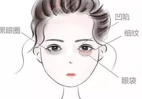 眼窩凹陷用什么填充好？