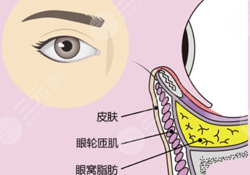 眼窩凹陷用什么填充好？