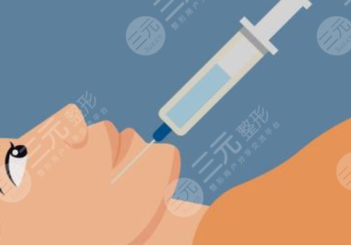 玻尿酸填充下巴有什么副作用？