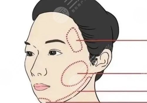 外輪廓固定內(nèi)輪廓填充的區(qū)別