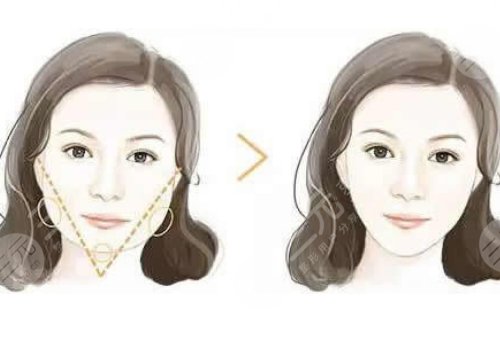 深圳美萊張華彬和黃海龍誰(shuí)技術(shù)好？