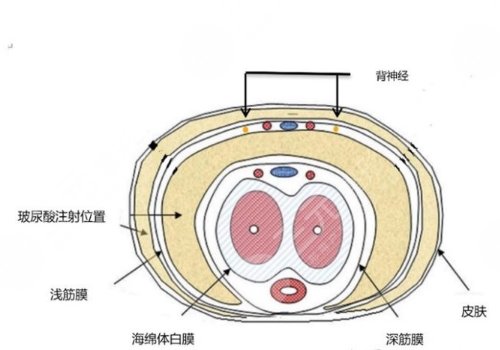 玻尿酸男性增大注射要多少錢？